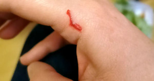 SOS Mon lapin m'attaque