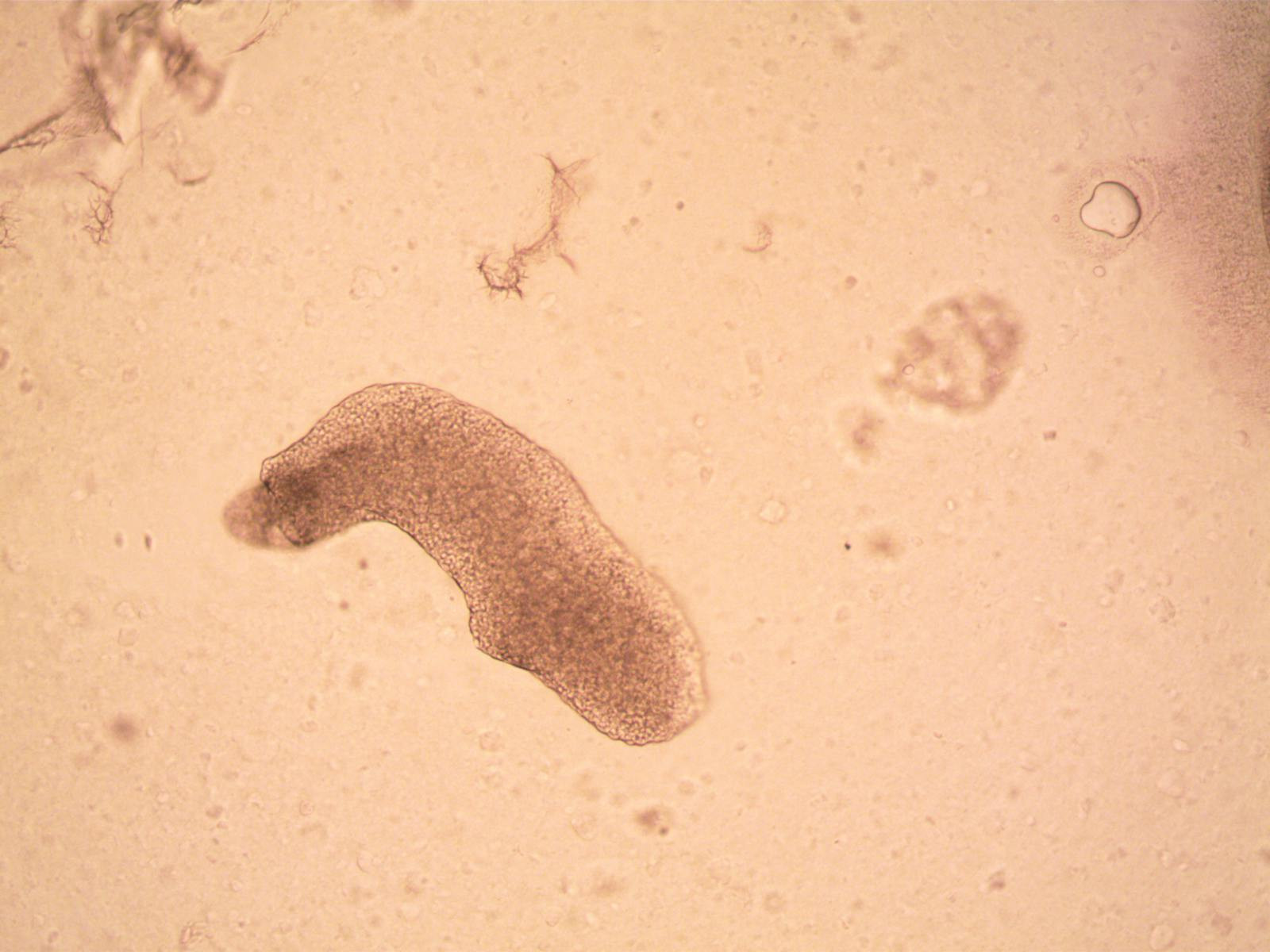Tardigrades : Les oursons d'eau révélés, maîtres de la survie extrême !