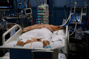 باسم الرشاقة تُزهَق الأرواح.. حين يتحوّل الوهم الرقمي إلى قرار طبي قاتل