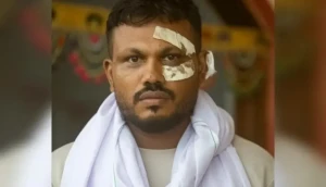 كوابيس لا تنتهي.. الناجي الوحيد من الطائرة الهندية يعيش بين الألم والنجاة