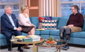 اتهام جراح بريطاني بقطع ساقيه عمداً للاحتيال على شركات التأمين