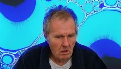 دراسة تكشف فروقاً بين الجنسين في معدلات الوفيات لدى مرضى الخرف