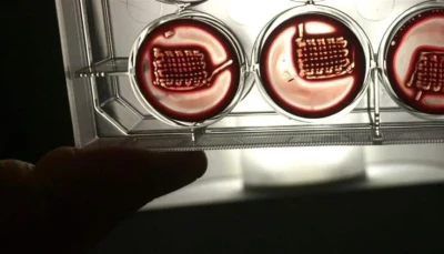 قطرة دم و2 دولار.. اختبار مذهل يرصد أخطر الأمراض بسرعة فائقة