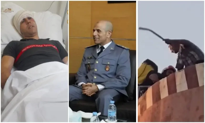 زملاء ضحية وحش "شاطو ولاد يوسف" يخرجون عن صمتهم بالتزامن مع ظهوره الأول بعد إجراء عملية جراحية ناجحة (صورة)
