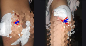 حادثة مؤلمة في شاطئ سلا: كلب شرس يهاجم طفلة وسط غياب المسؤولية